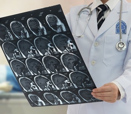 Neurology